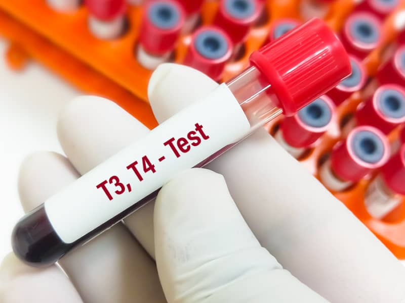 亜急性甲状腺炎・無痛性甲状腺炎